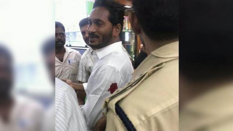 YSR Congress chief Jagan Mohan Reddy injured in attack YSR Congress chief Jagan Mohan Reddy injured in attack