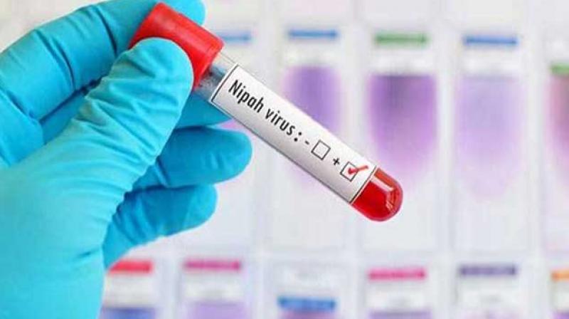 Deceased jawan's samples test negative for Nipah virus