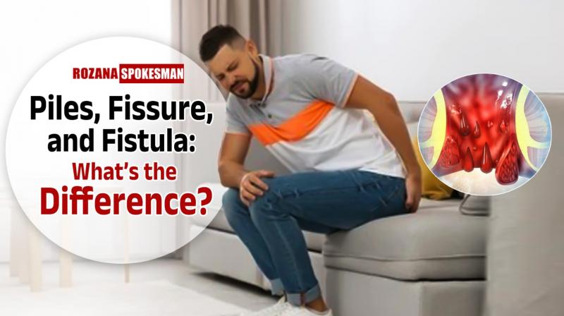 Piles, Fissure, and Fistula: What's the Difference? Piles, Fissure, and Fistula: What's the Difference?