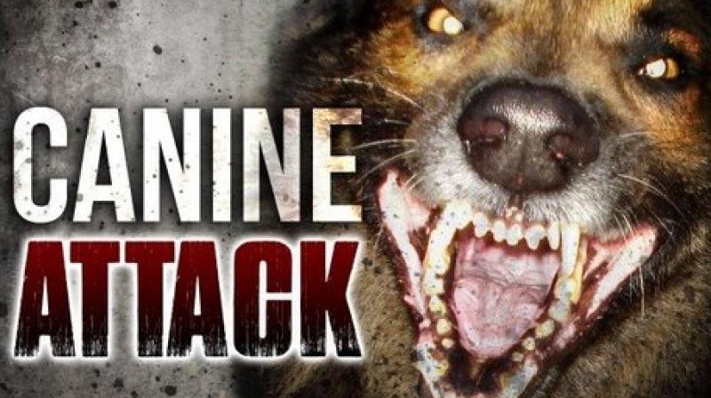 8-year-old boy dies in dog attack in UP 8-year-old boy dies in dog attack in UP