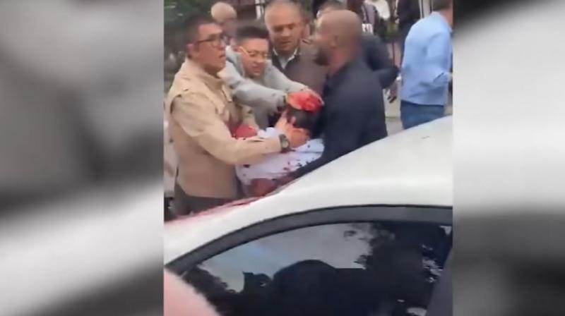 Colombian Presidential Candidate Miguel Uribe Shot During Rally, Suspect Detained Colombian Presidential Candidate Miguel Uribe Shot During Rally, Suspect Detained