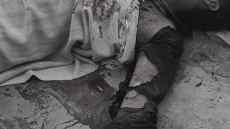 Punjab News: Major Accident While Loading Gunpowder into Potash Gun, 24-Year-Old Youth in Critical Condition Punjab News: Major Accident While Loading Gunpowder into Potash Gun, 24-Year-Old Youth in Critical Condition