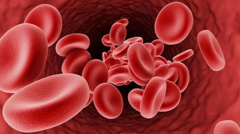 Thalassemia 