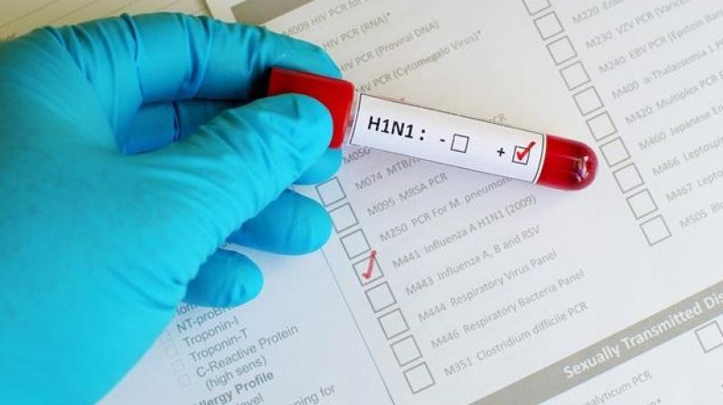 H1N1 virus H1N1 virus