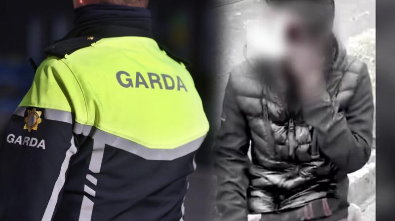 Ireland: Indian Assaulted, Stripped, and Left Bleeding by 'Racist Gang' Armed with Bladed Knuckles Ireland: Indian Assaulted, Stripped, and Left Bleeding by 'Racist Gang' Armed with Bladed Knuckles