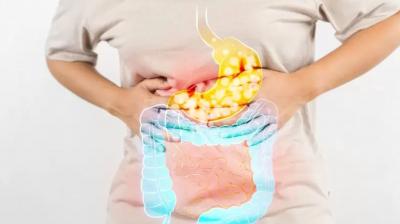 What is Chronic Constipation and Its Consequences?