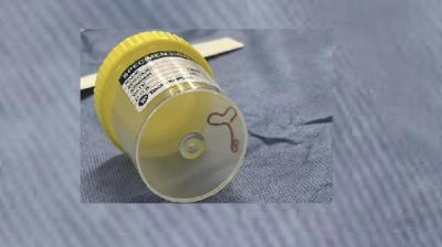 Roundworm