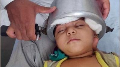 The little girl's head stuck in the cooker