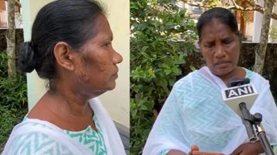 House Owner Released Dog, Claims BLO On SIR Duty In Kerala; Suffers Face Injuries