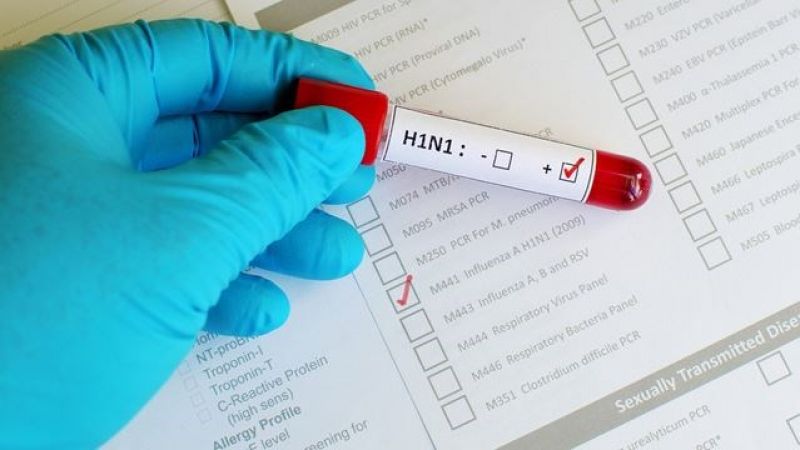 H1N1 virus