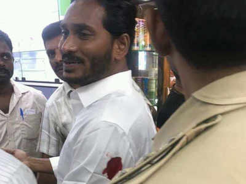He was injured in a knife attack at the Visakhapatnam airport