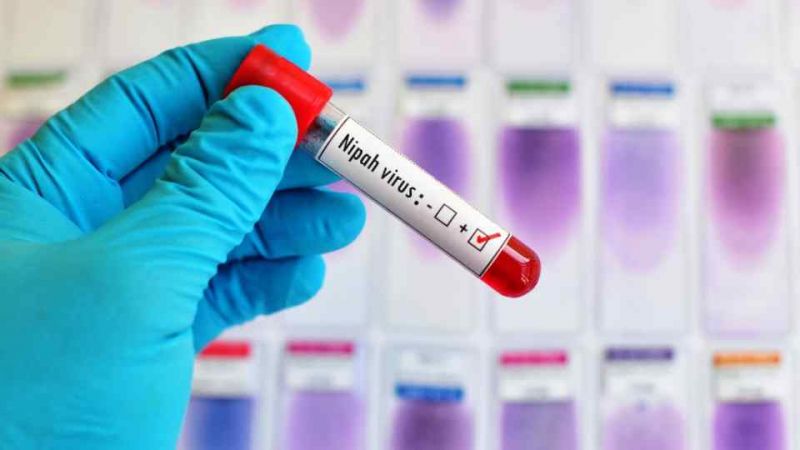 Another Nipah affected patient