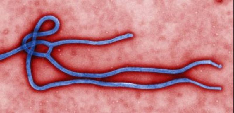 Ebola virus